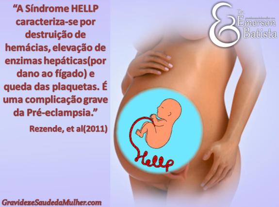 Pesquisar Mulher Em Rico Rio De Janeiro-2209
